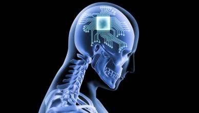 Chip implantado en el cerebro
