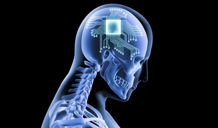 Chip implantado en el cerebro