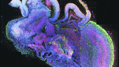 Miniorganoide cerebral